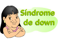 Ilustrao Sndrome de Down